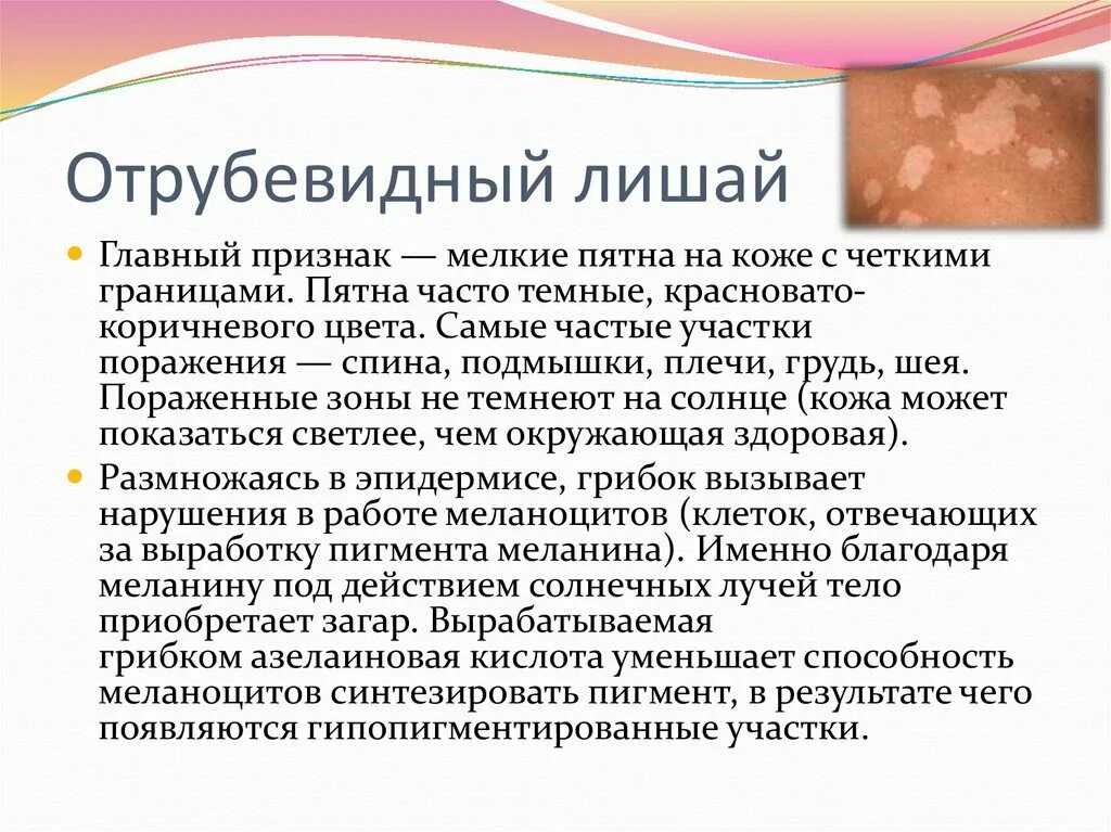 Разноцветный лишай фото у человека симптомы Микозы этиология