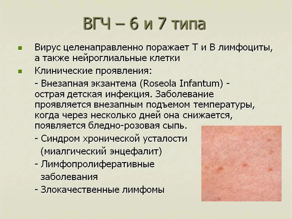 Разновидности герпеса на теле фото и описание Симптомы и лечение герпеса 6 типа у детей: чем опасен вирус в крови малыша и как