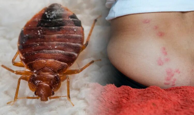 Разновидности постельных клопов фото и названия Bed bug bites: Three signs of an infestation - Rentokil reveals how to get rid o