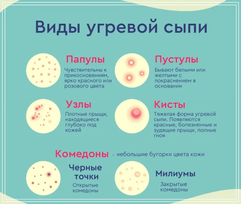 Разновидности сыпи фото и названия Угревая сыпь на лице: виды, причины и лечение в домашних условиях