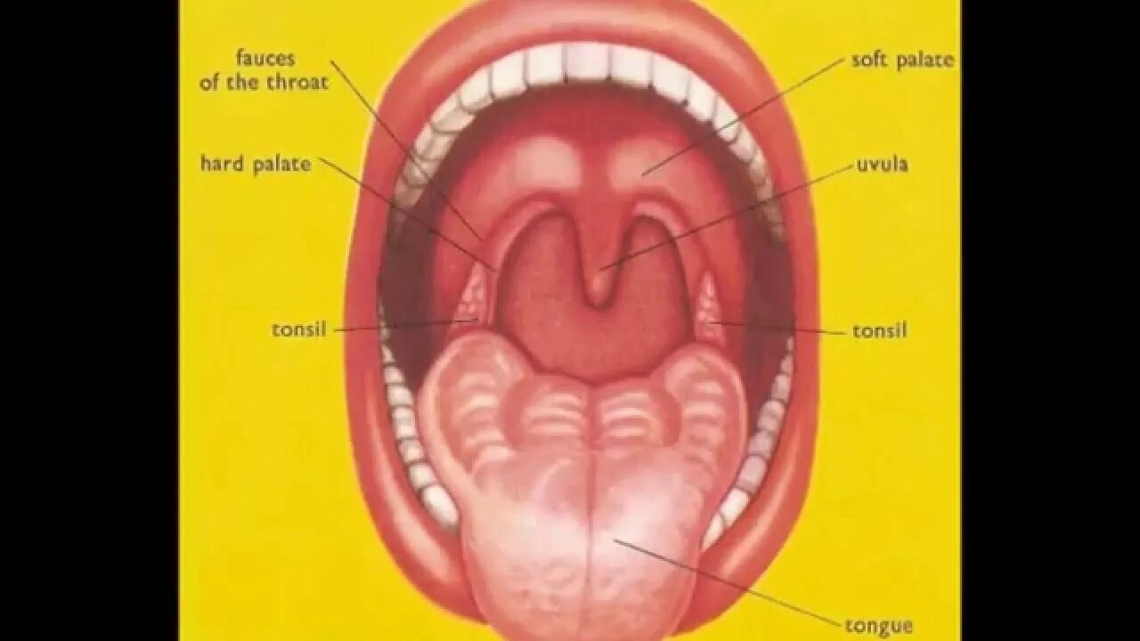 Разрастание лимфоидной ткани миндалины фото What are Tonsils and Adenoids (Sore throat pain) in children? Tonsils Adenoids T