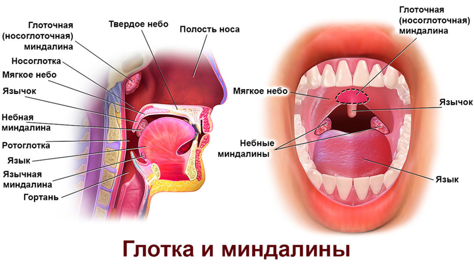 Разрастание лимфоидной ткани миндалины фото Уход за ротовой полостью: зубы, дёсна, миндалины здрава с Александром Крыгиным Д