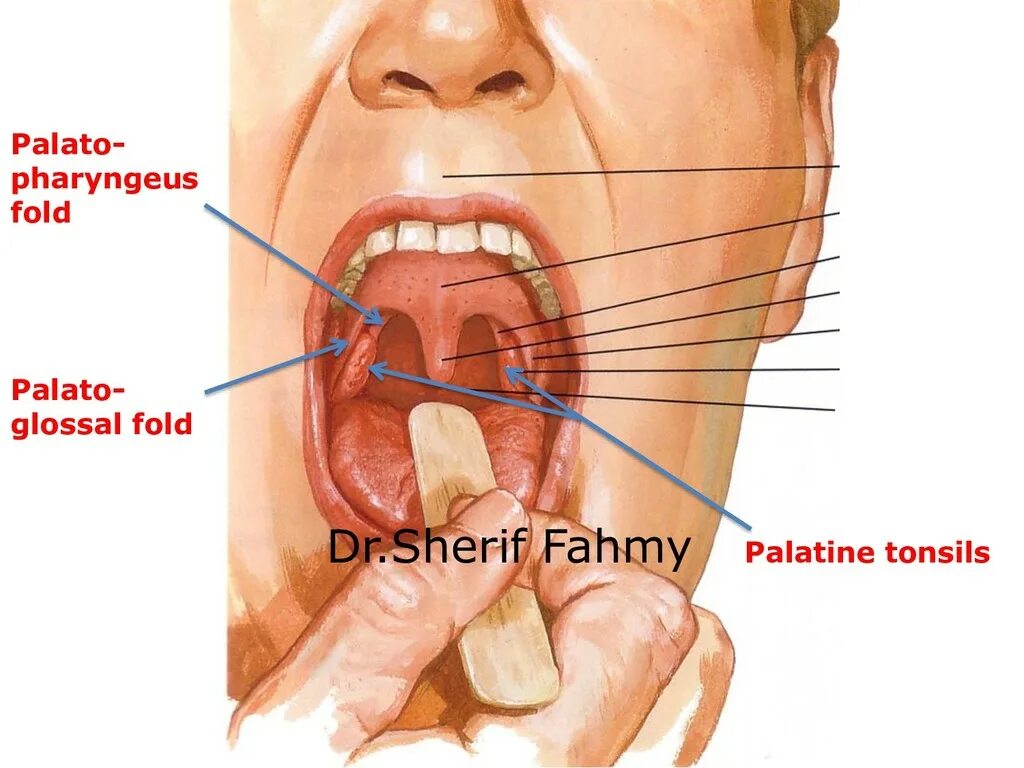 Разрастание лимфоидной ткани в горле фото Anatomy of the Neck - Speaker Deck