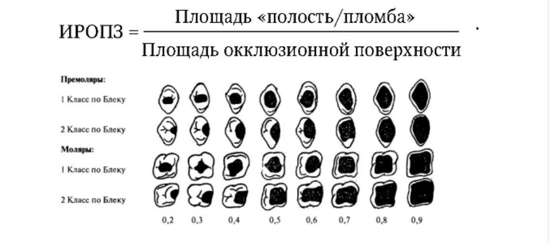 Разрушение зуба более 50 процентов как выглядит Хорошая пломба vs плохая пломба / Хабр