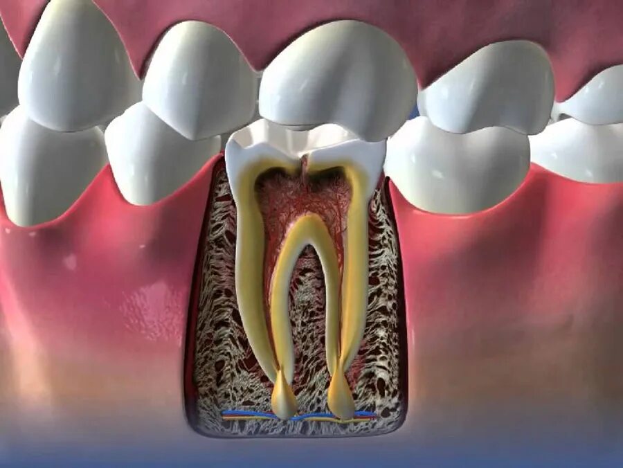 Разрушенный зуб фото Корни зубов: особенности верхней и нижней челюсти, анатомия жевательных и постоя