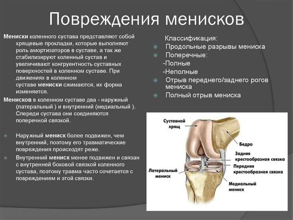 Разрыв мениска коленного сустава симптомы фото Повреждение мениска симптомы и лечение