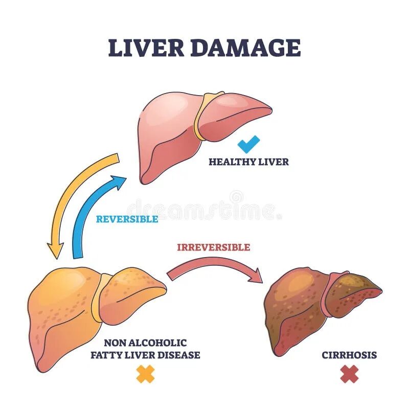 Разрыв печени фото Liver damage concept. stock illustration. Illustration of page - 49221768