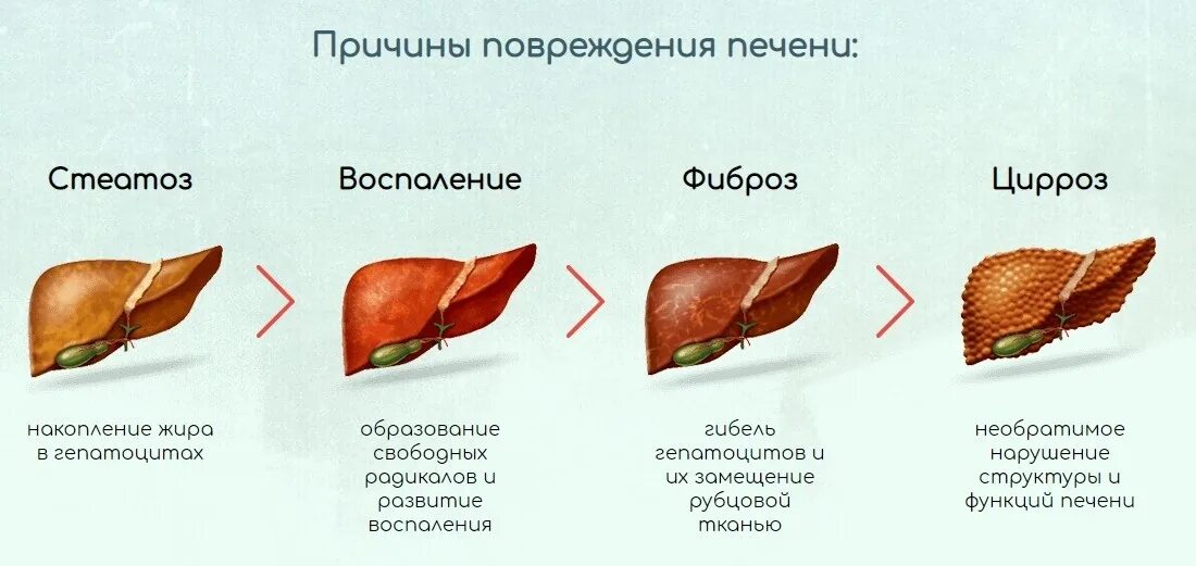 Разрыв печени фото Если печень сильно повреждена и отказывает, возможна печеночная кома - что это т