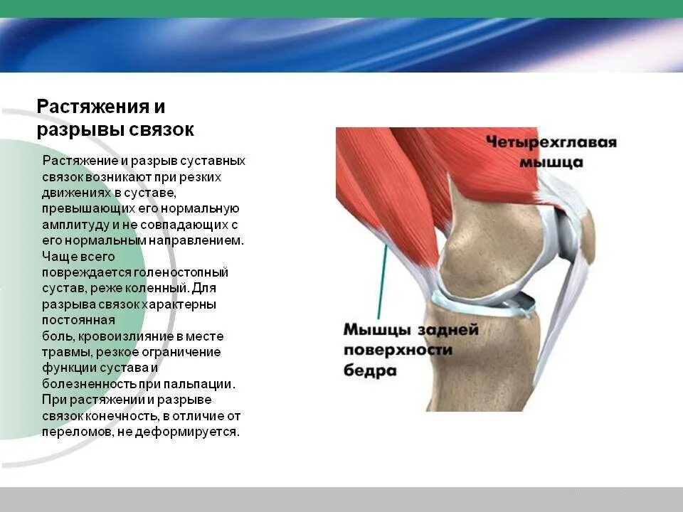 Разрыв связок коленного сустава симптомы фото Растяжение мышц сколько проходит