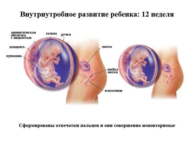 Развитие плода 12 недель фото Жизнь с одним яичником. Последствия после удаления одного яичника ЭКО-блог