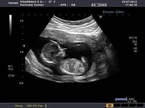 Развитие плода 14 недель фото Pin by Sharon Iieaha Foster on pregnancy ultrasound Unborn baby, Mom and dad, Un