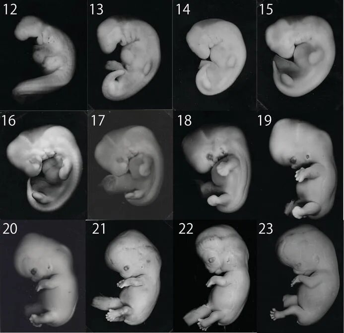 Развитие плода по месяцам фото Congenital Anomalies in Human Embryos IntechOpen