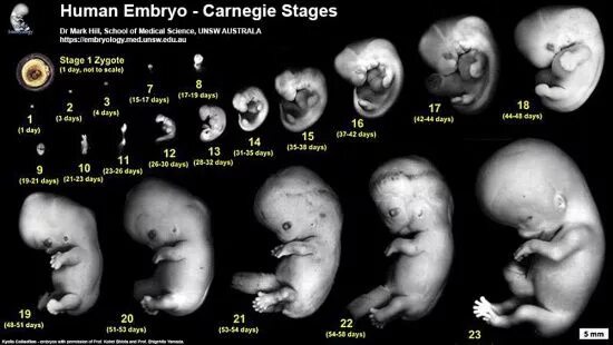 Развитие плода по месяцам фото Embryonic Development - Embryology