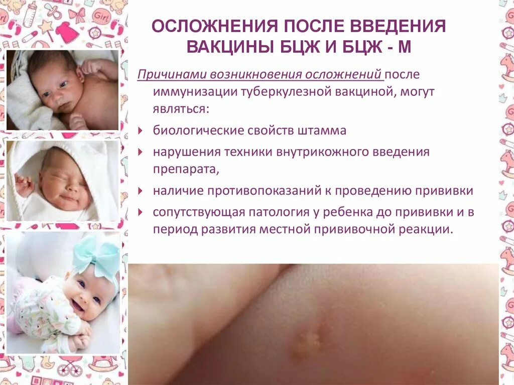 Реакция бцж по месяцам фото Когда и зачем делают вакцинацию БЦЖ младенцам в роддоме: заживление, осложнения