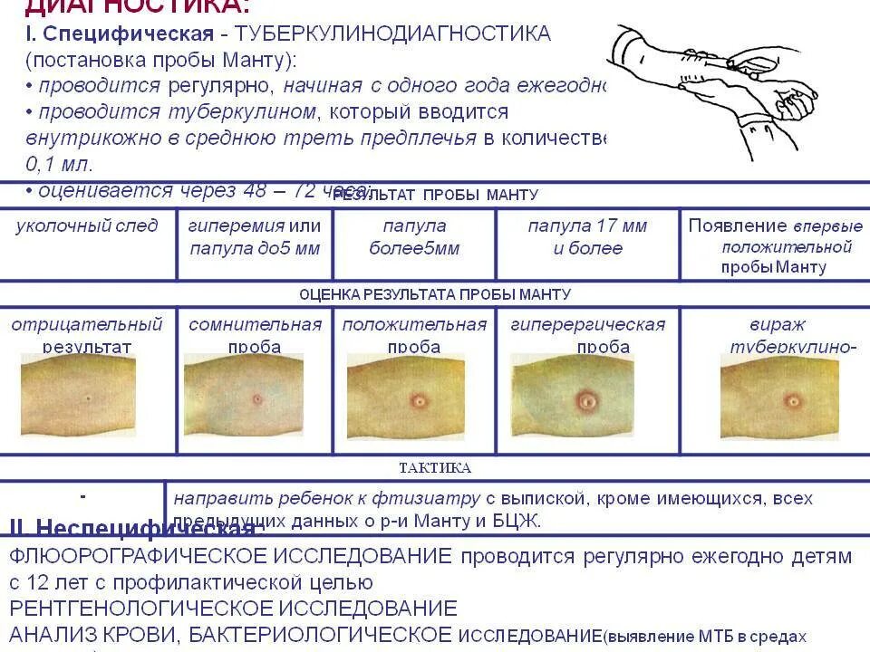 Реакция бцж по месяцам фото Что нельзя делать после манту