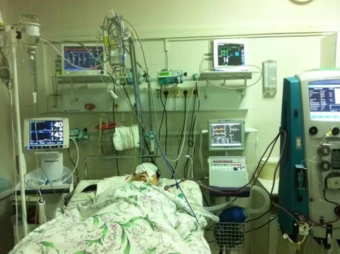 Реанимация отделение фото Doctors connected to the ventilator": 13-year-old boy entangled in a hammock and