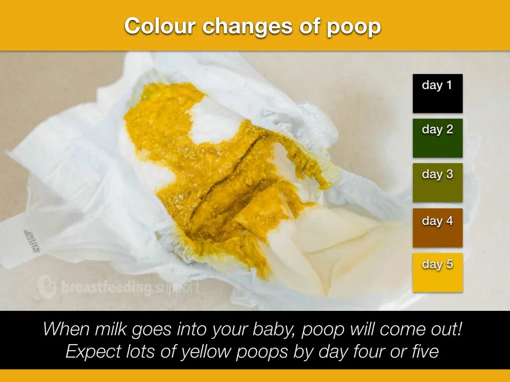 Ребенку 1 месяц стул фото 6 Day Old Baby Poop Colour Best Sale glomart.kz