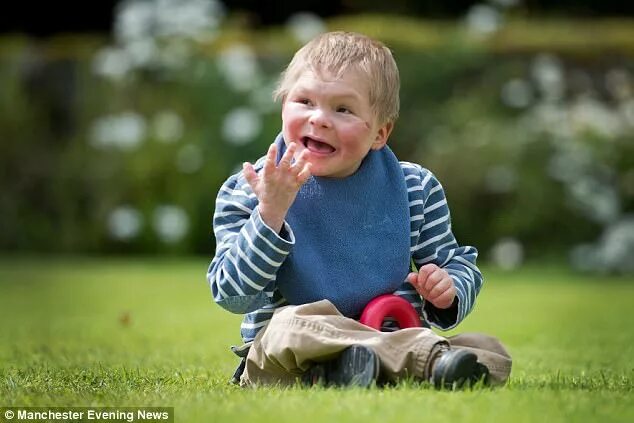 Ребенок 3 дня фото Teenage boy looks like a toddler thanks to rare syndrome Daily Mail Online