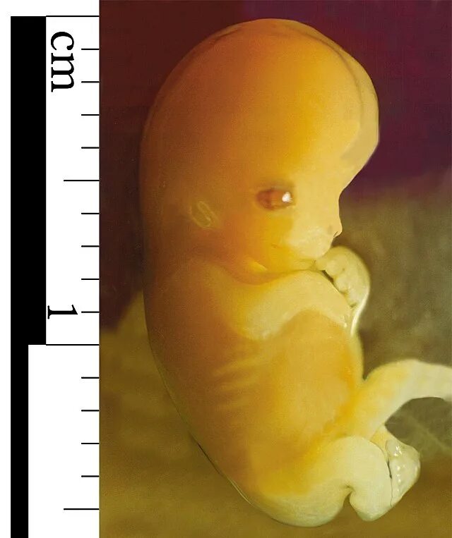 Ребенок 7 недель фото Embryo - Wikipedia