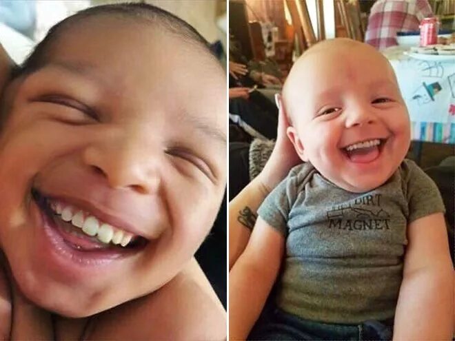 Ребенок родился без неба фото Babies With Grown-Up Teeth Look Terrifying Baby memes, Our baby, Funny