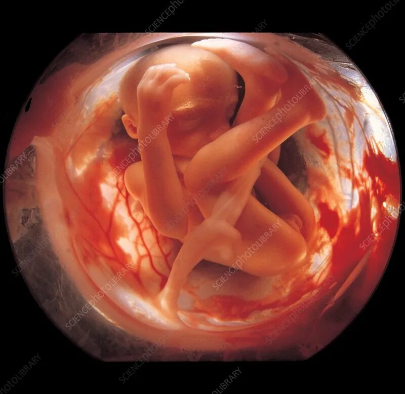 Ребенок в утробе 12 недель фото Foetus in amniotic sac, 26 weeks - Stock Image - C048/7865 - Science Photo Libra