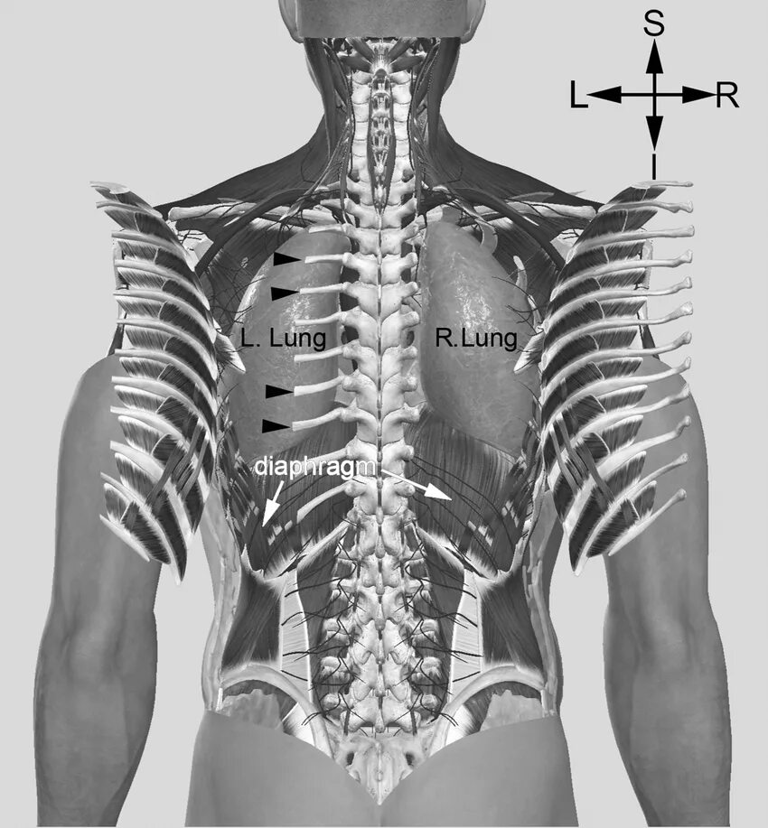 Ребра по номерам фото A posterior view of the thorax illustrating the results of detaching or... Downl