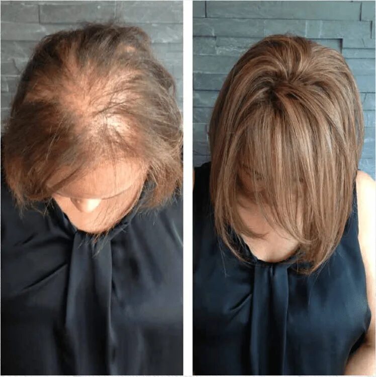 Редкие волосы какую прическу сделать Screen Shot 2015-11-05 at 4.47.12 AM Extensions for thin hair, Thin hair solutio