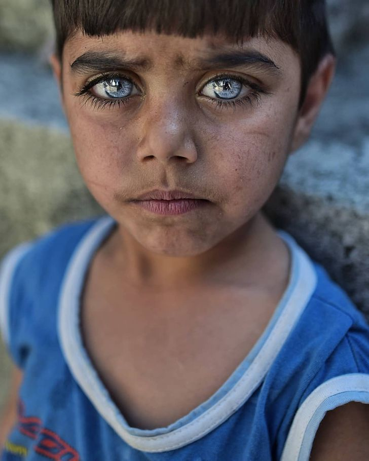 Редкий цвет глаз фото Turkish Photographer Captures the Beauty of Children’s Eyes That Shine Like Gems