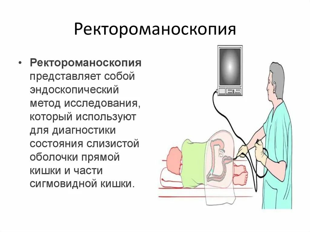 Ректороманоскопия при геморрое как выглядит Ректороманоскопия ирригоскопия: найдено 86 картинок