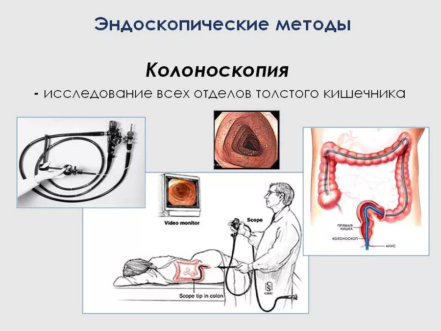 Ректороманоскопия при геморрое как выглядит Лечение кишечника. Лечение лечение кишечника от ведущих докторов Лучшие клиники 