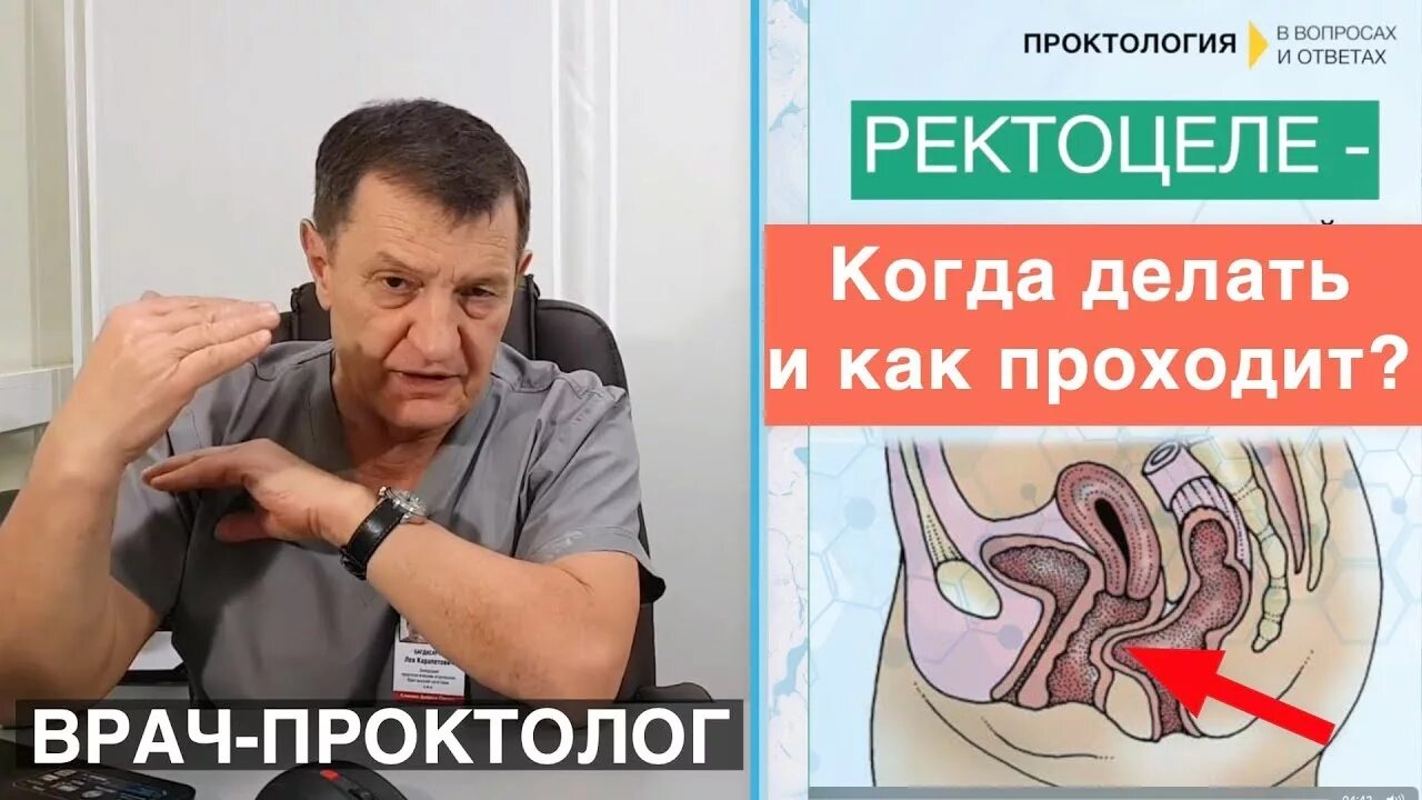 Ректоцеле что это такое у женщин фото Операция ректоцеле - как проходит? Безумно страшно! - YouTube