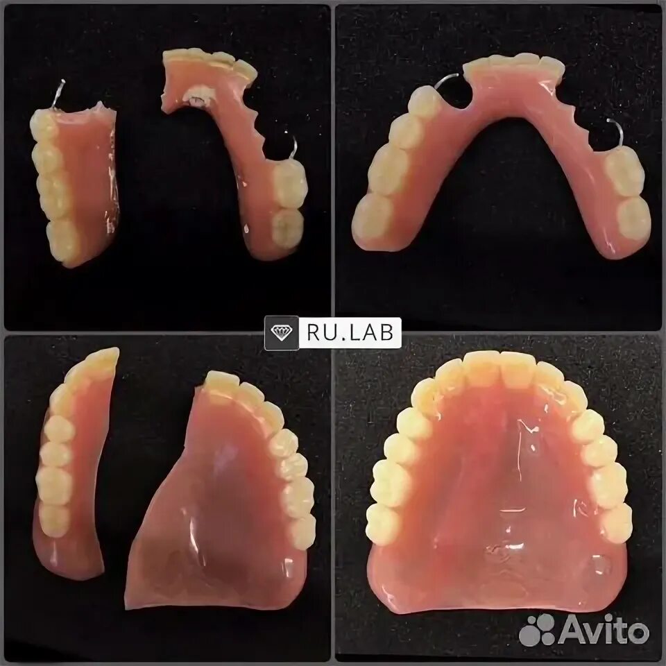 Ремонт зубного протеза своими руками Ремонт зубных протезов за час в Москве Услуги Авито