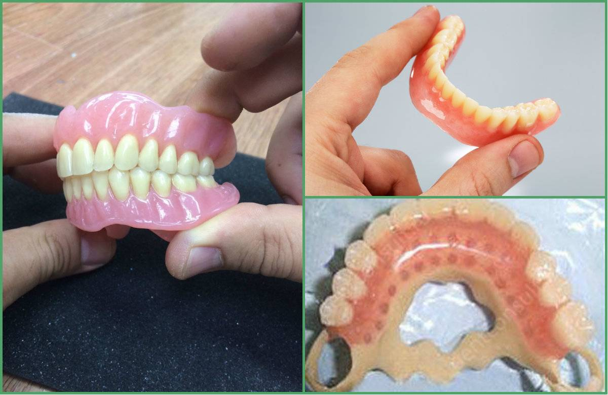 Ремонт зубного протеза своими руками Какие зубные протезы лучшие, виды, отзывы, рекомендации