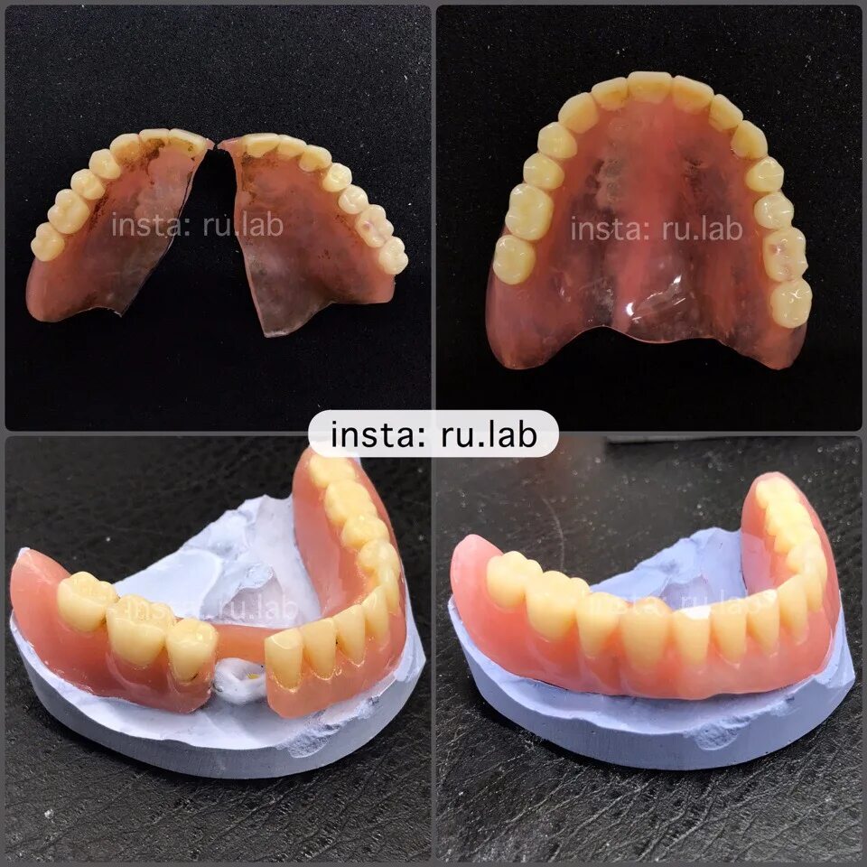 Ремонт зубного протеза своими руками Ремонт зубных протезов Руслан - 89255557151 #зубнойтехник 2019 Ремонт зубных про