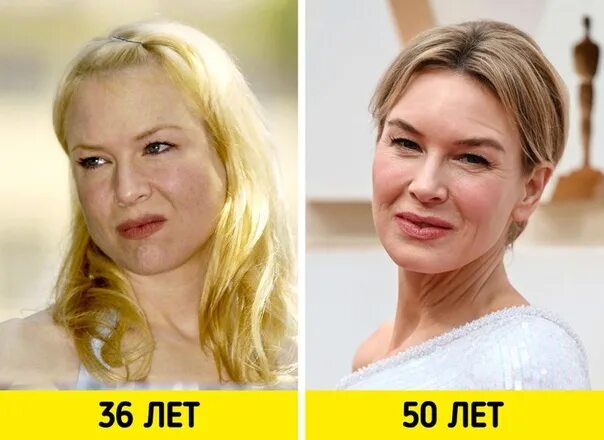 Рене зеллвегер до и после фото Renee Zellweger 2022 тогда / сейчас VK