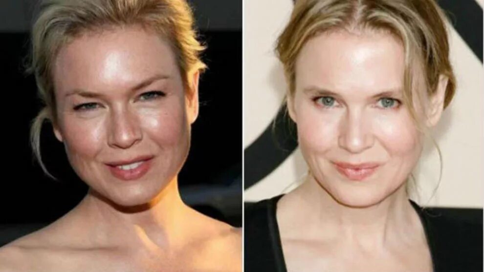 Рене зеллвегер до и после фото Renée zellweger MARCA.com