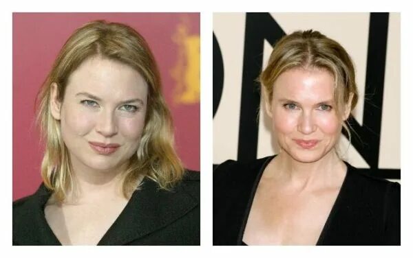 Рене зеллвегер до и после фото La dieta Renée Zellweger y su transformación. INCREÍBLE!