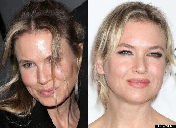 Рене зеллвегер до и после фото Renee Zellweger Looks Unrecognisable As She Debuts New Face In LA (PICTURES) Huf