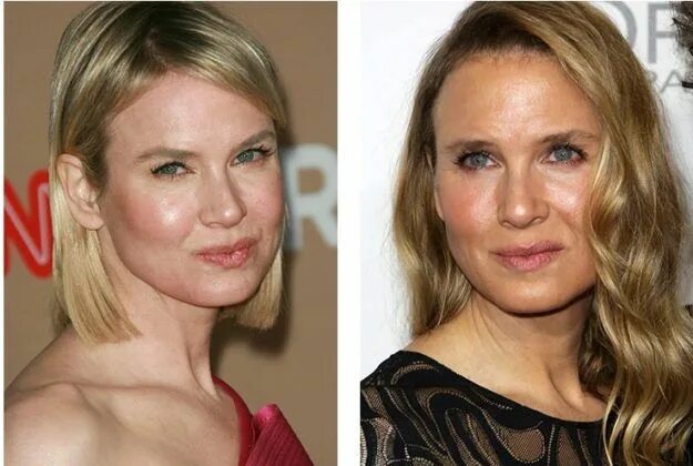 Рене зеллвегер до и после пластики фото A couple of years ago, Renée Zellweger was very surprised by the public. It can 