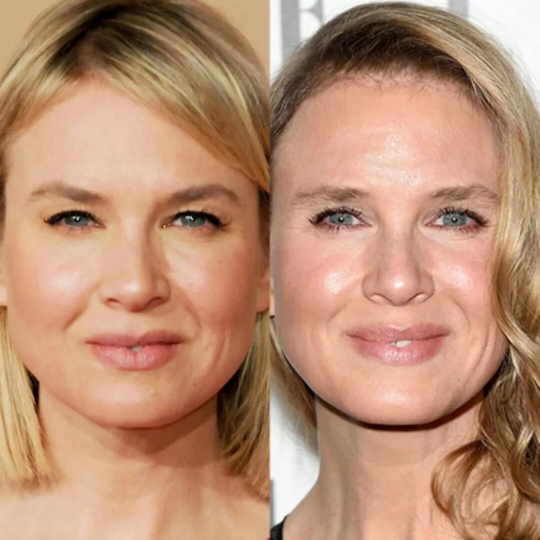 Рене зеллвегер до и после пластики фото Renée Zellweger Explains Why Her Face Looks Different