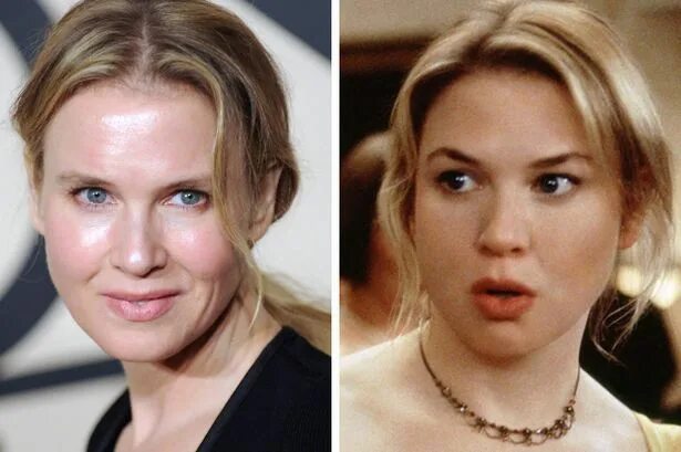 Рене зеллвегер до и после пластики фото O novo rosto de Renée Zellweger