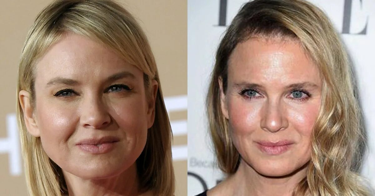 Рене зеллвегер фото пластика KLG to Renée Zellweger critics: Let her be