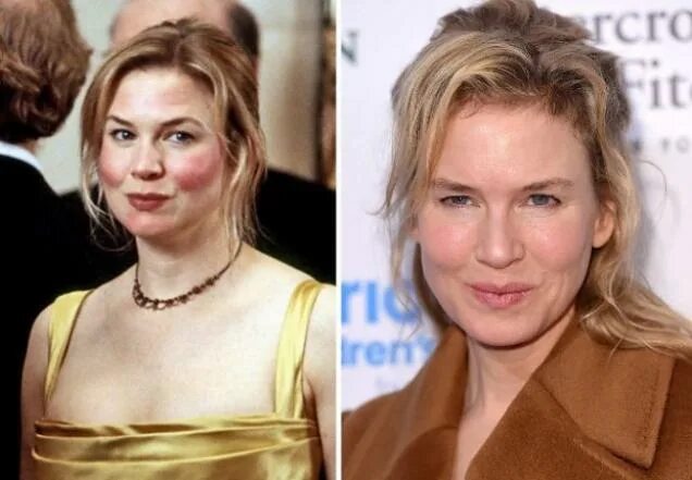 Рене зеллвегер как выглядит сейчас The Actors And Actresses From Bridget Jones, Oh How They Changed - Wow Gallery e