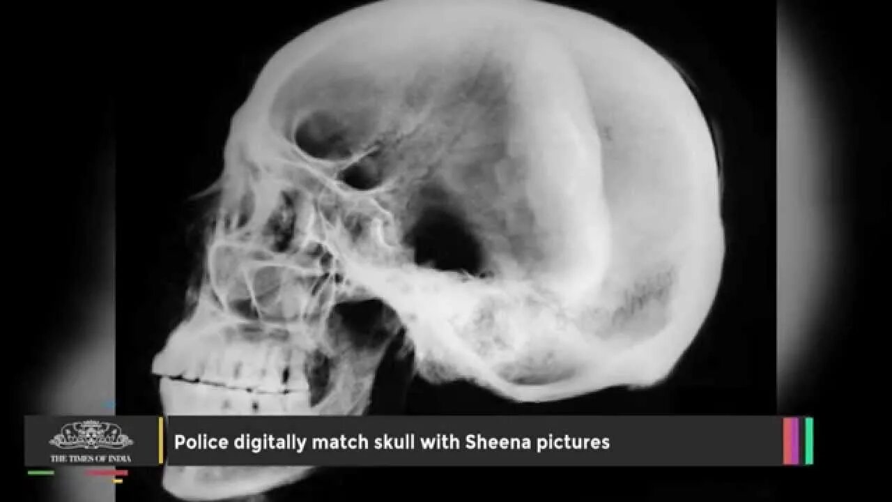 Рентген черепа фото Sheena Bora Murder Skull Recovered Matches the Facial Features of Sheena Bora - 