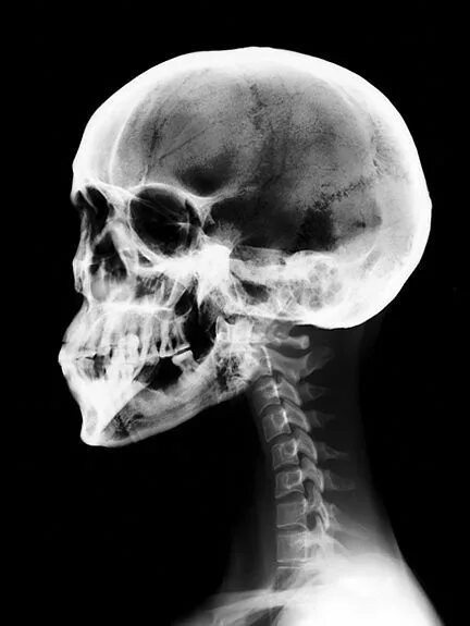 Рентген черепа фото 10 популярных идей на тему "skull xray" для вдохновения