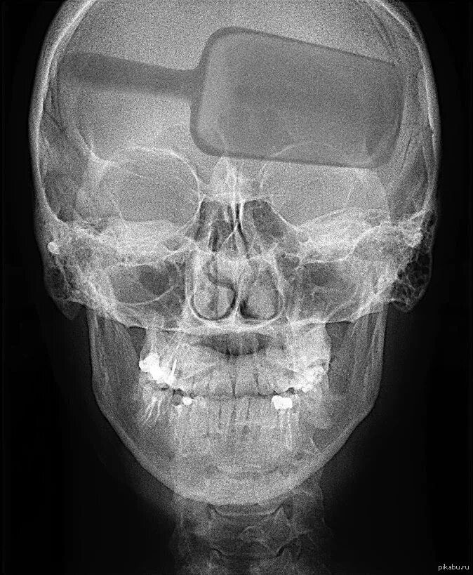 Рентген черепа фото Предположительно, снимок сотрудника Почты России. Пикабу