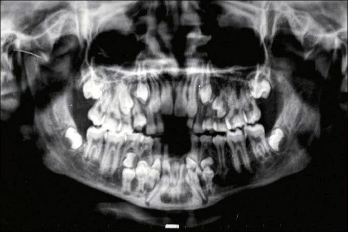 Рентген детских зубов фото @archillect : https://t.co/AGkPUuymXT