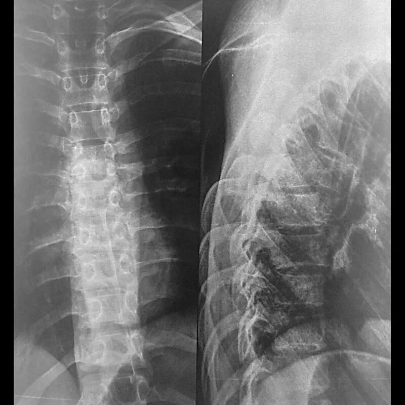 Рентген грудного отдела позвоночника фото Цены на выезд травматолога с рентгеном на дом в Москве и области