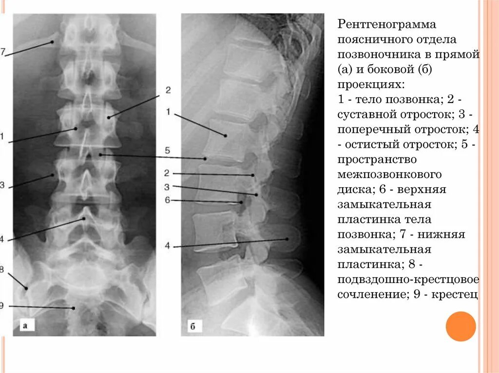 Рентген грудного отдела позвоночника фото Рентген грудного отдела позвоночника описание, фото, цена