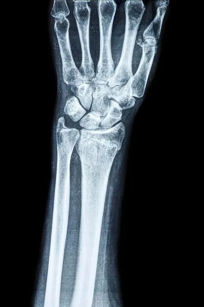 Рентген лучевой кости фото страница 3 Фото Bone Fracture, более 34 000 качественных бесплатных стоковых фот